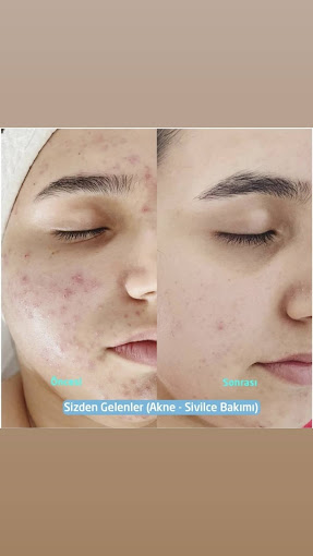 Siempre Belleza Guzellik Merkezi Yuksekova