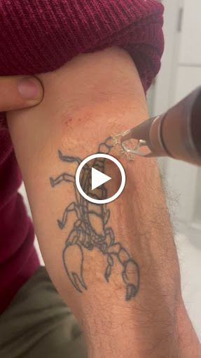 Art Lazer Epilasyon Guzellik Merkezi